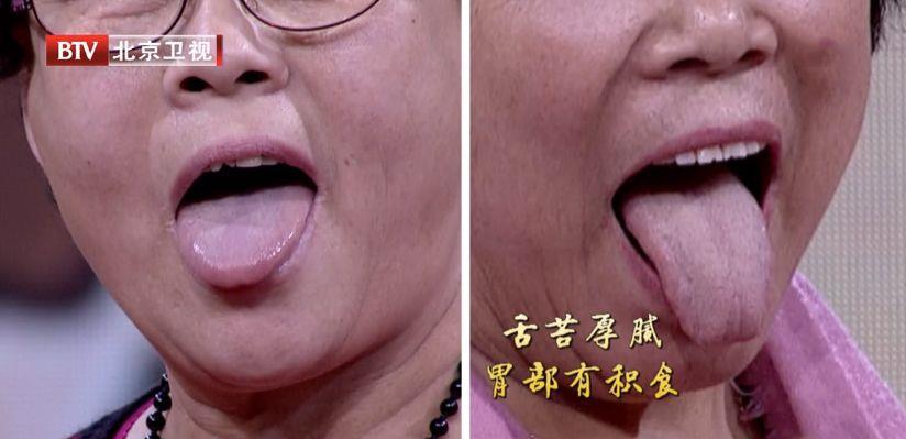 老中医的养生秘诀:每天坚持这样做,补肾健脑长寿! 鹿血片 第5张 老中医的养生秘诀:每天坚持这样做,补肾健脑长寿! 鹿血片 第5张