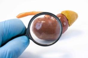 肾病不是治不好,肾病治疗的五个误区 鹿血片 第1张 肾病不是治不好,肾病治疗的五个误区 鹿血片 第1张