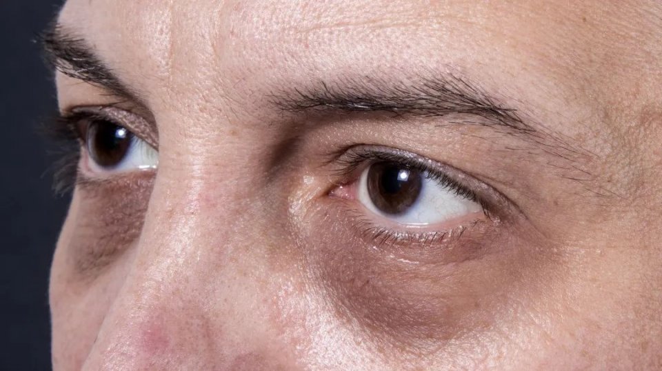 由于肾的不合作,极有可能影响你的六大状况 鹿血片 第1张 由于肾的不合作,极有可能影响你的六大状况 鹿血片 第1张