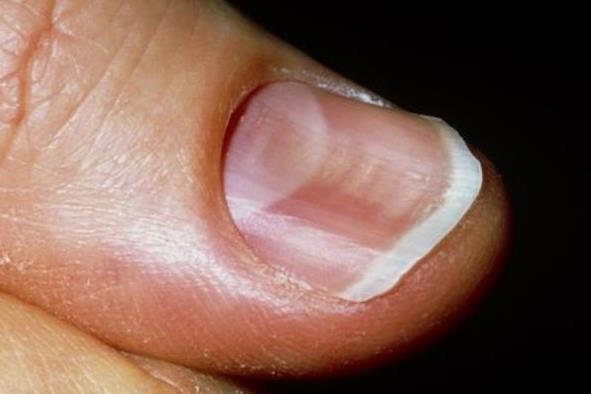 男性“腰肾”疲软,1个中药食疗方,日常吃点,年轻力壮精神好! 鹿血片 第2张 男性“腰肾”疲软,1个中药食疗方,日常吃点,年轻力壮精神好! 鹿血片 第2张