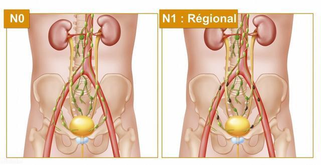 肾气虚导致的前列腺问题,多见于肾阳不足,淤血阻滞 鹿血片 第1张 肾气虚导致的前列腺问题,多见于肾阳不足,淤血阻滞 鹿血片 第1张