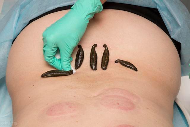 肾气虚导致的前列腺问题,多见于肾阳不足,淤血阻滞 鹿血片 第5张 肾气虚导致的前列腺问题,多见于肾阳不足,淤血阻滞 鹿血片 第5张