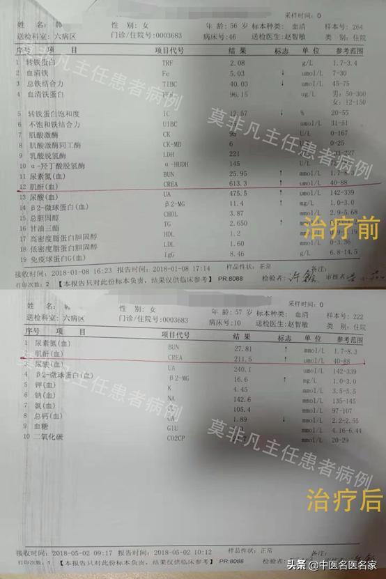 慢性肾衰竭是尿毒症的预备军,56岁的肾衰阿姨却赢了这场战斗 鹿血片 第2张 慢性肾衰竭是尿毒症的预备军,56岁的肾衰阿姨却赢了这场战斗 鹿血片 第2张