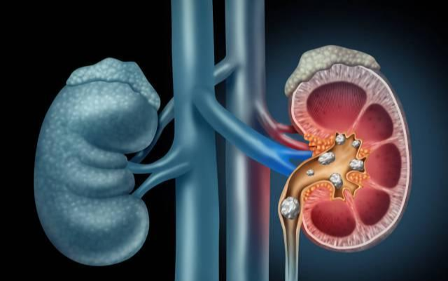 寿命“短”的男性,6个特征比较突出!占得越少,寿命或许越长 鹿血片 第3张 寿命“短”的男性,6个特征比较突出!占得越少,寿命或许越长 鹿血片 第3张