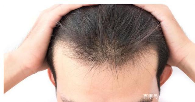 肾脏由盛到衰的3个特征,若你一个没有,说明你身体非常好 鹿血片 第2张 肾脏由盛到衰的3个特征,若你一个没有,说明你身体非常好 鹿血片 第2张