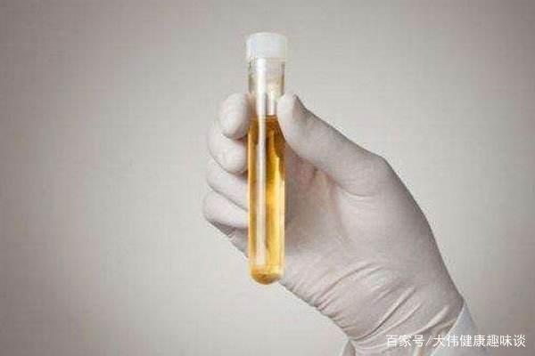 肾脏不好，有3个表现会提示你，坚持两件事，助你养护肾脏 鹿血片 第1张