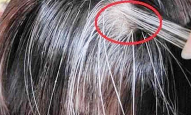 经常“熬夜” 的人，5个测试满足2个以上，说明肾虚了，要补了 鹿血片 第2张