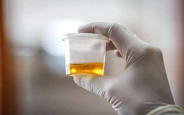 “三甜”最伤肝，尽量少吃，“两苦”养肝，宜多吃，必须谨记在心 鹿血片 第3张