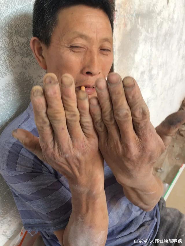 手淫对身体有益，但不宜过于频繁，常喝一种水，可改善你的肾动力 鹿血片 第1张