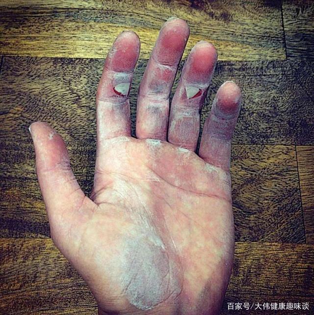 手淫对身体有益，但不宜过于频繁，常喝一种水，可改善你的肾动力 鹿血片 第4张