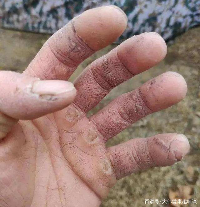 手淫对身体有益，但不宜过于频繁，常喝一种水，可改善你的肾动力 鹿血片 第6张