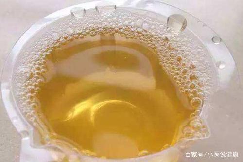 男人关键时刻就掉链子?做好这两件事,促进夫妻感情 鹿血片 第1张 男人关键时刻就掉链子?做好这两件事,促进夫妻感情 鹿血片 第1张