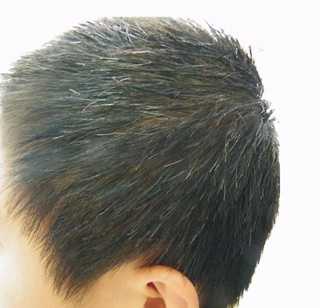 名中医亲授！每天对小拇指做1事，5大效果意想不到，还能防癌 鹿血片 第5张