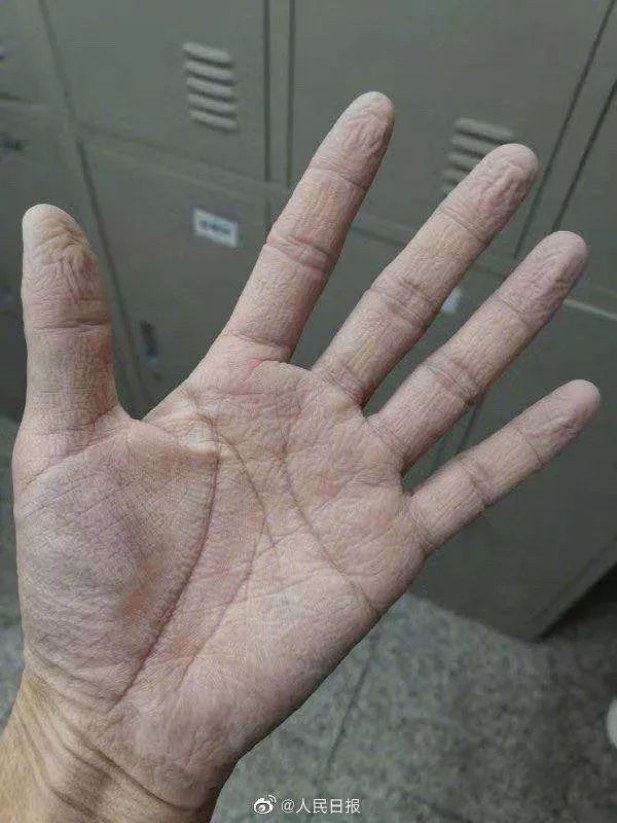 上海突然官宣！疫情放开后最苦的这群人，该被看到了 鹿血片 第9张